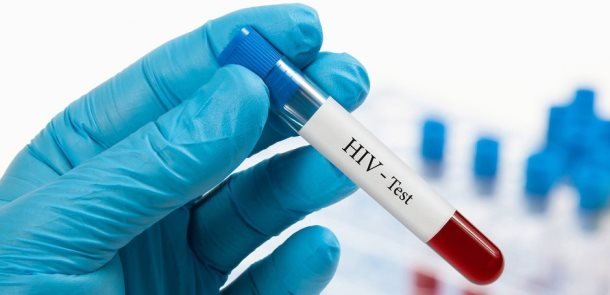 Tibbdə inqilab: HİV virusunun müalicəsi tapıldı
