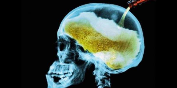 Spirtli içkilərin insan beyninə təsiri
