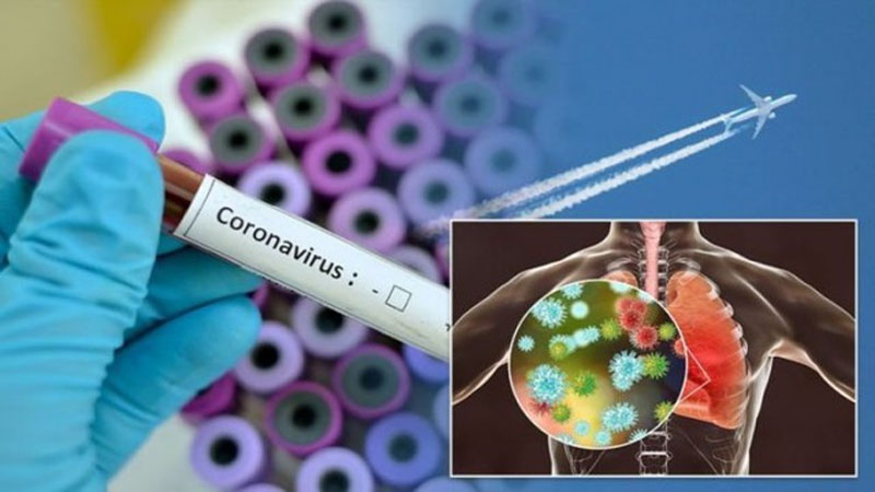 ÜST: Azərbaycanda koronavirusa yoluxma halı qeydə alınmayıb