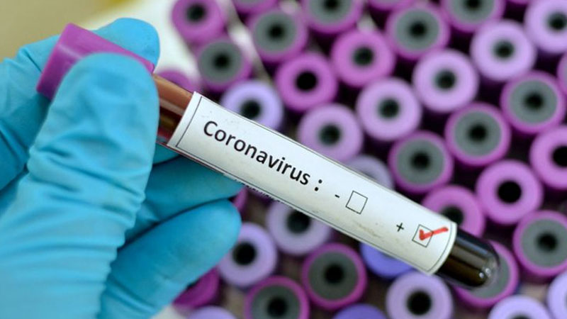 Azərbaycanda koronavirusa yoluxanların ümumi STATİSTİKASI
