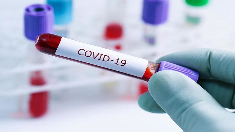 Dünyada son sutkada koronavirusa yoluxanların statistikası