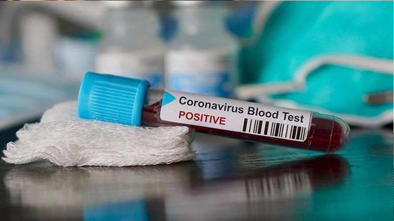 Koronavirusun yeni episentri məlum oldu