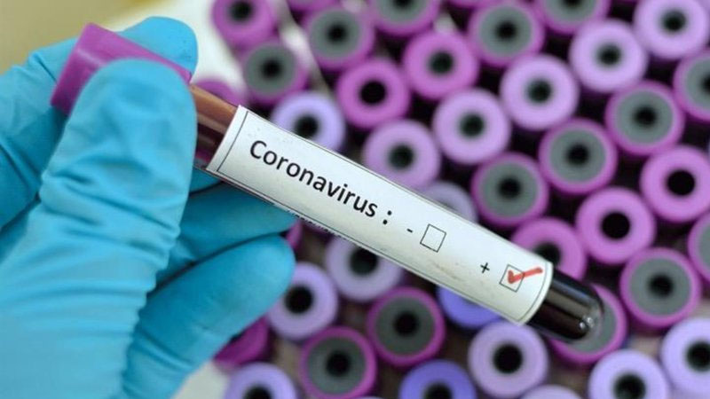 Azərbaycanda daha bir həkim koronavirusdan öldü (FOTO)