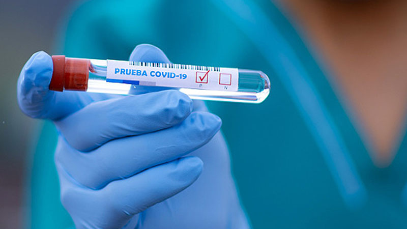 Səhiyyə Nazirliyi: “Rusiyda koronavirusa qarşı peyvənd könüllü olacaq”