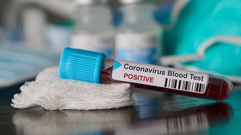 TƏBİB: “Koronavirus testlərinin qiymətlərinə qarışmırıq”