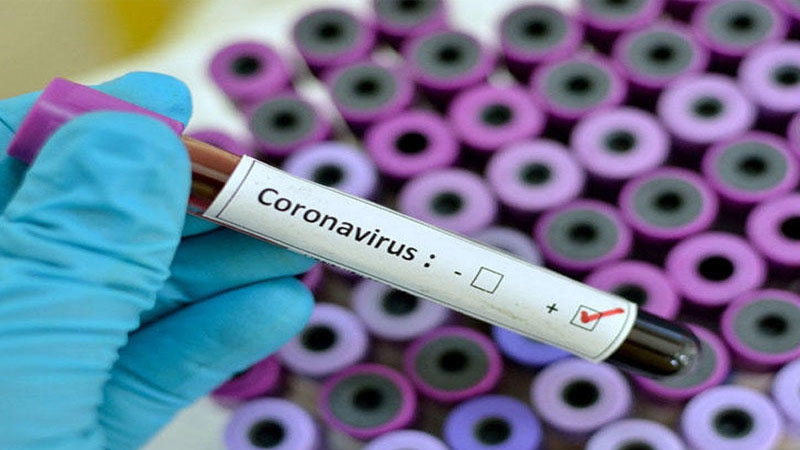Son sutkada koronavirusa yoluxanların sayı 1000-i keçdi, 9 nəfər öldü