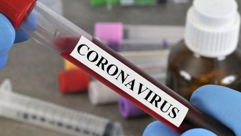 Azərbaycan daha 2 milyon doza “CoronaVac” vaksini alacaq