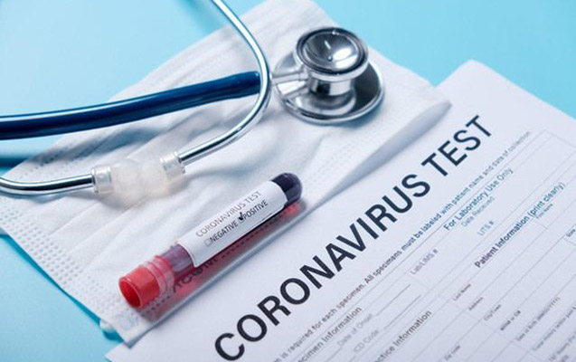 Koronavirusa yoluxanların sayı 500-dən aşağı düşdü